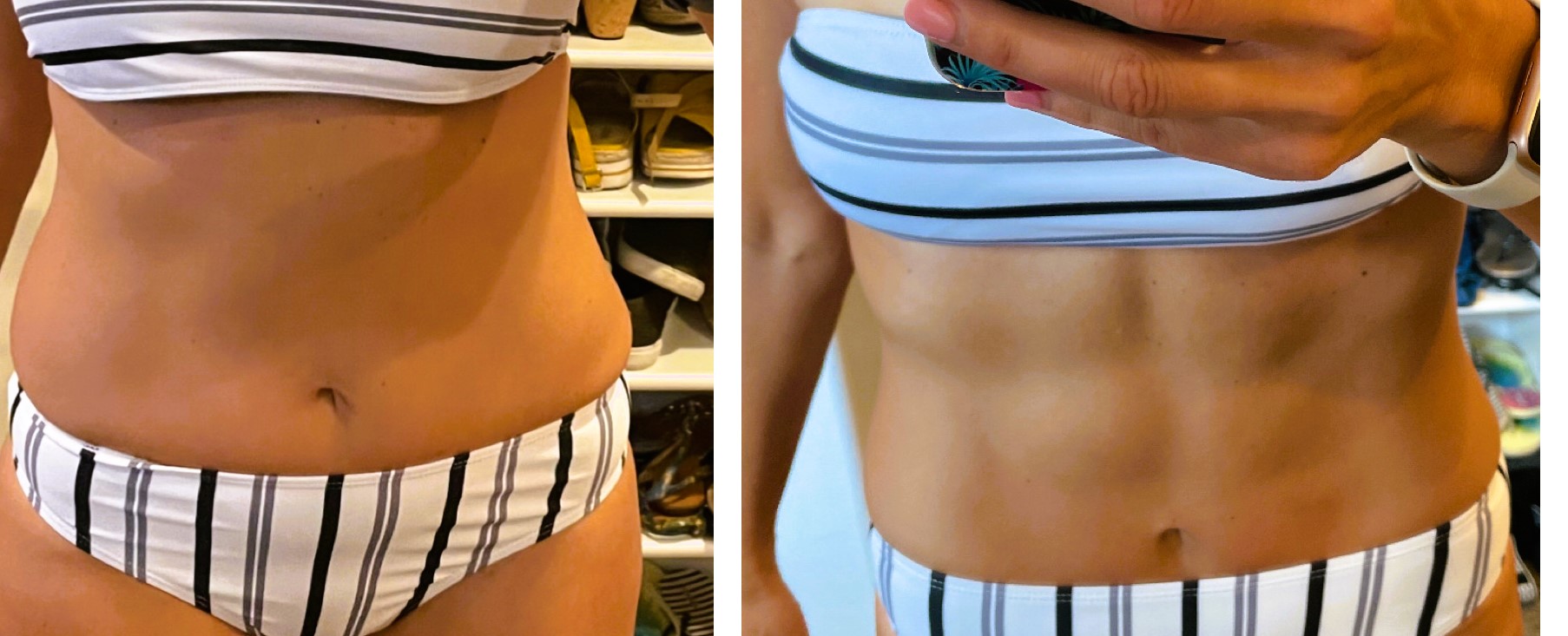 Women with Em Scupt before and after Treatment | APEX Performance & Aesthetics in Sandy, UT